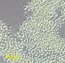 Blooms Cyanobacteria 2 Usgs Blooms Cyanobacteria 2 Usgs
