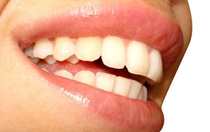 Smile Teeth Web