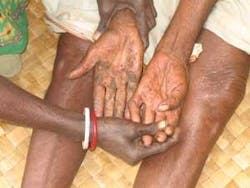 Th Arsenic Mitigation 05 Th Arsenic Mitigation 05