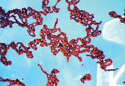 Resin Gold Resin Gold