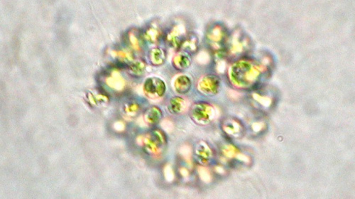 Content Dam Ww Online Articles 2017 06 Microcystis Aeruginosa