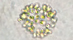 Content Dam Ww Online Articles 2017 06 Microcystis Aeruginosa