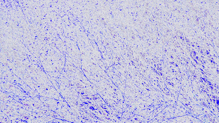 Content Dam Ww Online Articles 2018 09 Membrane Blue