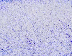 Content Dam Ww Online Articles 2018 09 Membrane Blue Content Dam Ww Online Articles 2018 09 Membrane Blue