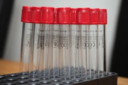 Content Dam Ww Online Articles 2017 01 3945656390 2d78b9c0b1 B Content Dam Ww Online Articles 2017 01 3945656390 2d78b9c0b1 B