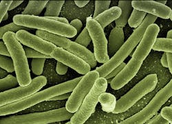 Koli Bacteria 123081 640 5d83a849b3494 5d8bb2bd440c7 Koli Bacteria 123081 640 5d83a849b3494 5d8bb2bd440c7