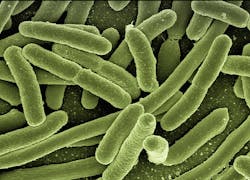 Koli Bacteria 123081 640 5d83a849b3494 Koli Bacteria 123081 640 5d83a849b3494