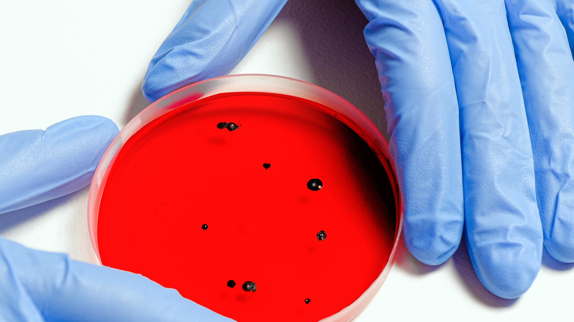 Sewage surveillance has a major role to play in tracking and understanding coronavirus outbreaks.