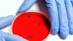 Sewage surveillance has a major role to play in tracking and understanding coronavirus outbreaks. Sewage surveillance has a major role to play in tracking and understanding coronavirus outbreaks.