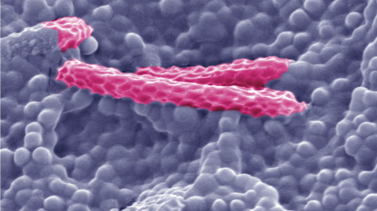 Main 5 Trehalose 5kv 25000 0501 5f4ff87195f72