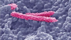 Main 5 Trehalose 5kv 25000 0501 5f4ff87195f72 Main 5 Trehalose 5kv 25000 0501 5f4ff87195f72