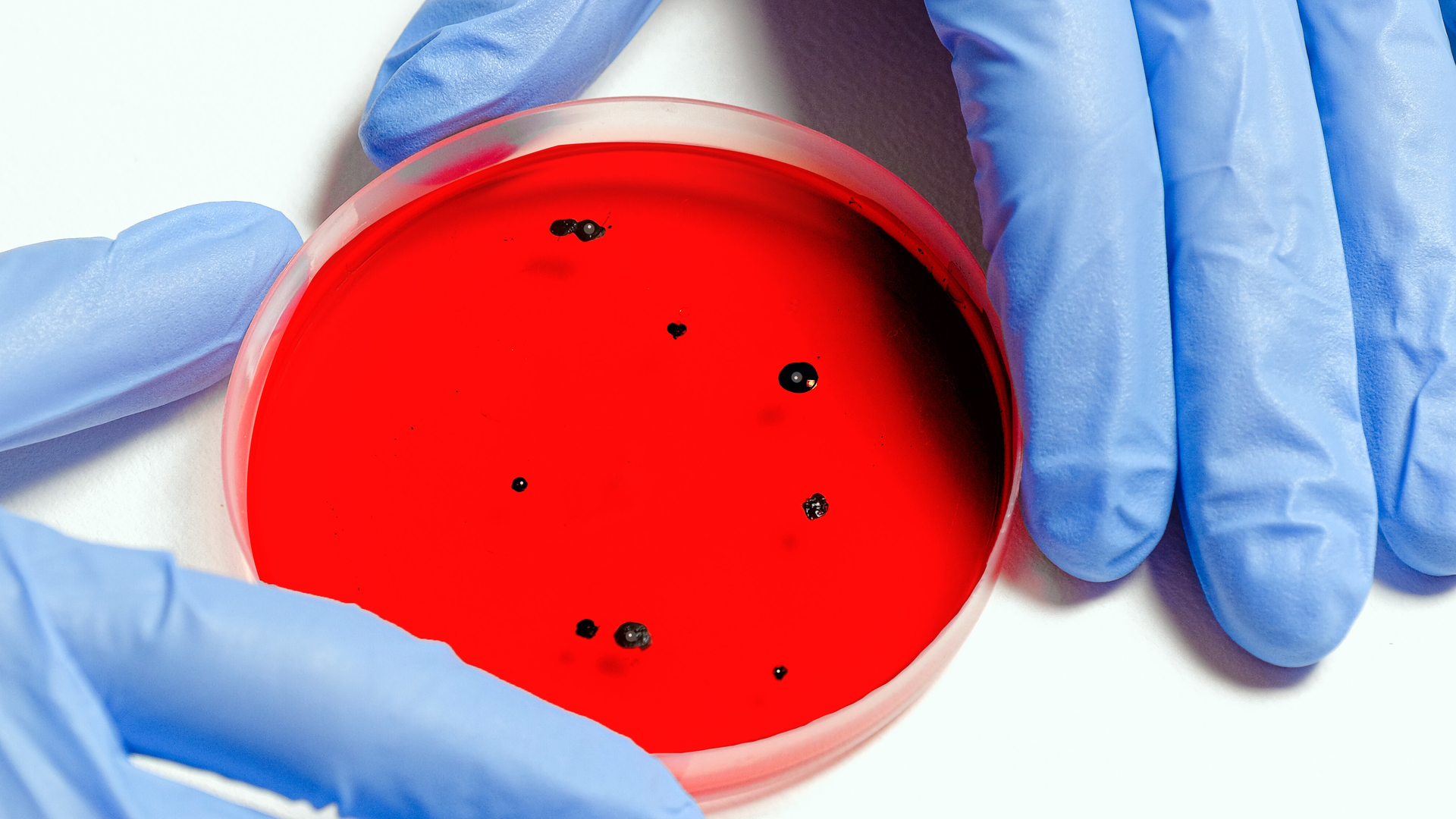 Pexels Anna Shvets 3786247 5f7dcb74eb19d