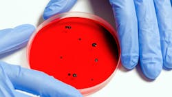 Pexels Anna Shvets 3786247 5f7dcb74eb19d Pexels Anna Shvets 3786247 5f7dcb74eb19d