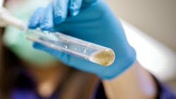 Zobellella denitrificans ZD1 bacteria feed on sludge (both shown in test tube) to make biodegrade bioplastics. Zobellella denitrificans ZD1 bacteria feed on sludge (both shown in test tube) to make biodegrade bioplastics.