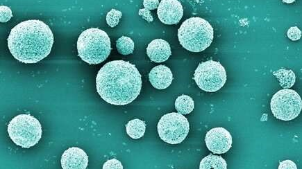 Ceramic granules made of aluminum oxide were coated with a nanometer-thin layer of copper oxide, as shown here at 5,000-fold magnification (electron microscopy, colored).