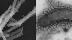 Ultrasmall parasitic bacteria (Mycosynbacter amalyticus) attach to the larger wastewater foaming bacterial cells (Gordonia pseudoamarae) leading to cell lysis. Imaged under scanning electron microscope. Ultrasmall parasitic bacteria (Mycosynbacter amalyticus) attach to the larger wastewater foaming bacterial cells (Gordonia pseudoamarae) leading to cell lysis. Imaged under scanning electron microscope.