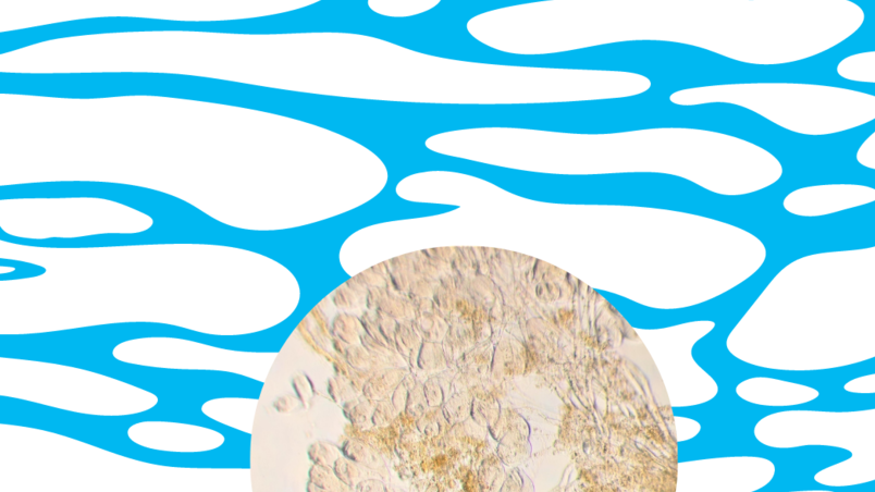 Bacteria in a microscopic image.