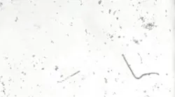 Movement of Paramecium at 1x & 5x permissible limit concentrations of volatile organic compounds (VOCs) water pollutants.