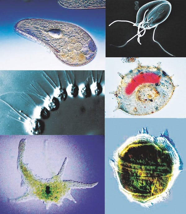 65e7260ca9f492001e1be03f Protozoa Collage Edit